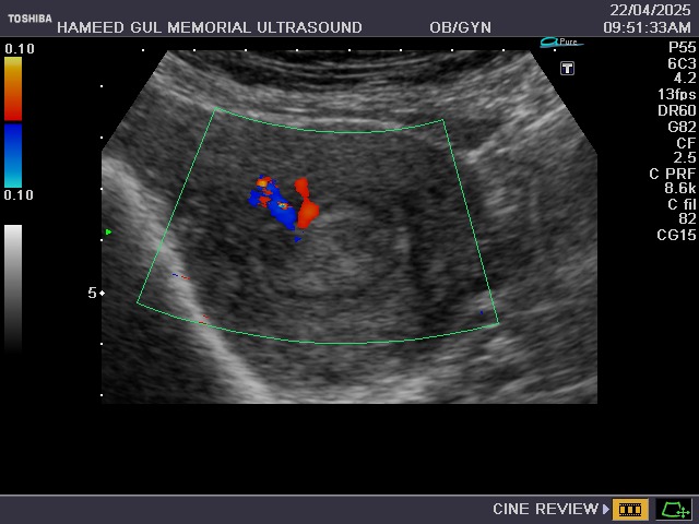 Pelvic Ultrasound Image
